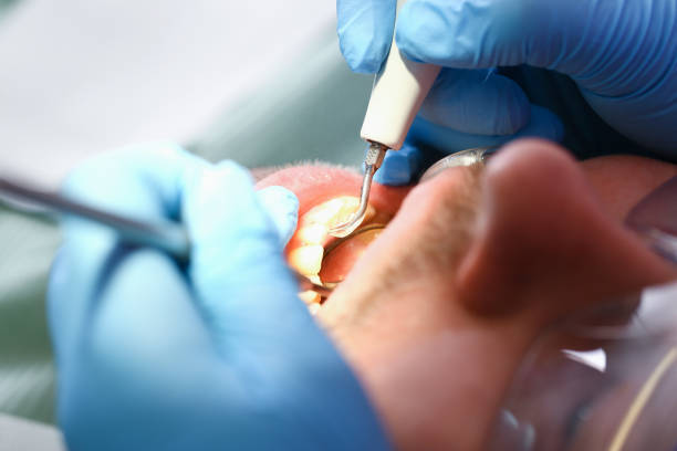 Best Pediatric Emergency Dentist in Suncrest, WA